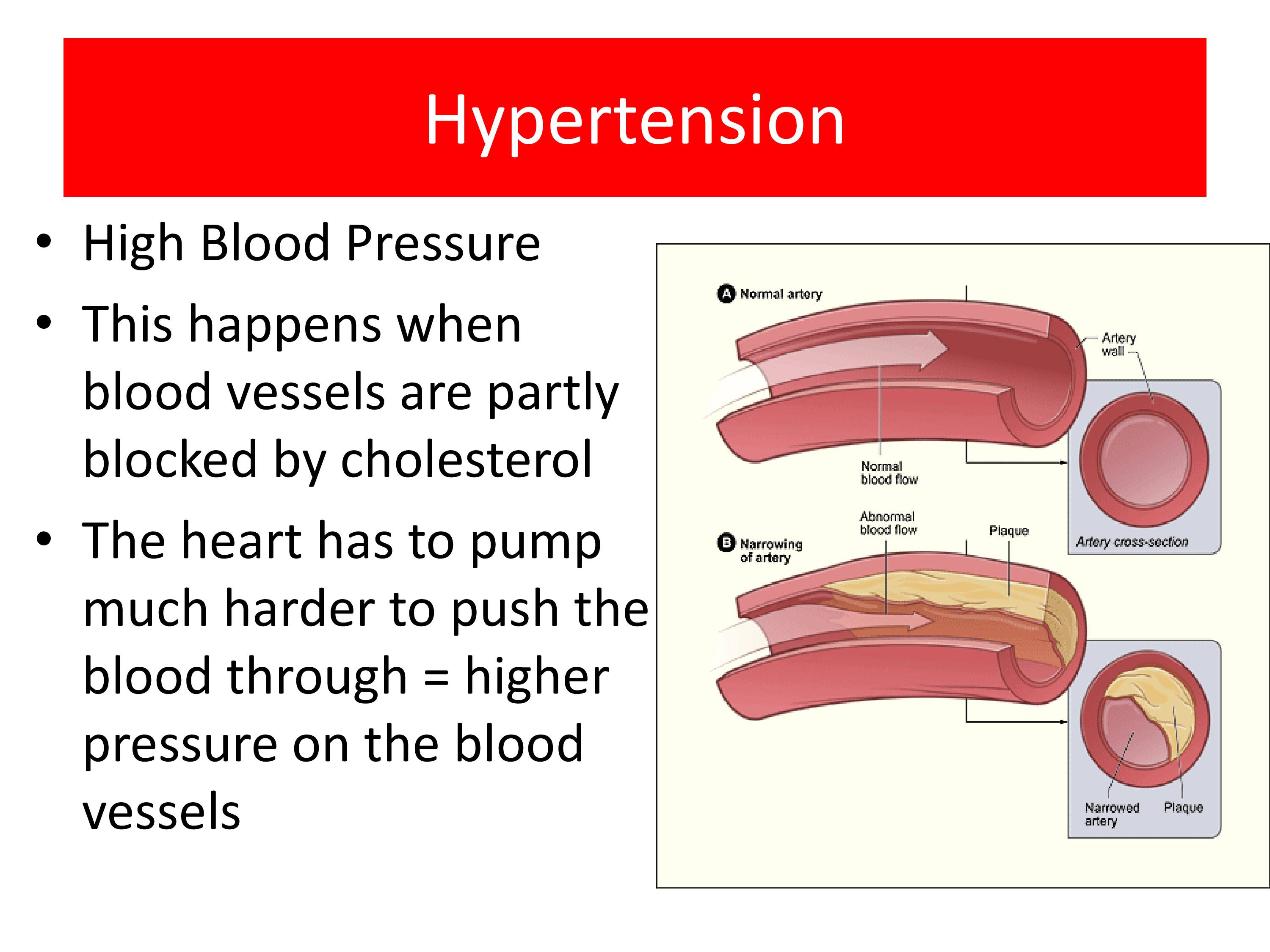 Blood Pressure software, free download For Mobile